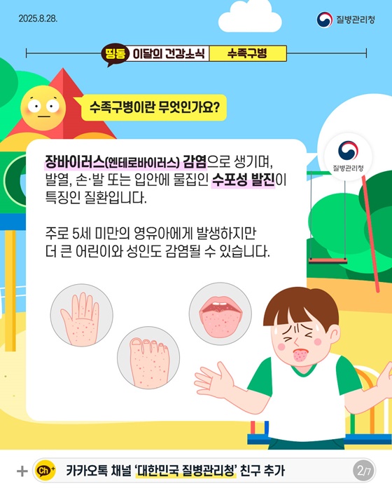 영유아에게 흔한 감염병, 수족구병 예방수칙