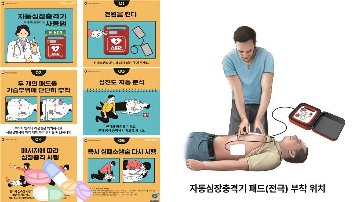 기본소생술에서는 자동심장충격기(automated external defibrillator, AED) 사용률 제고와 심장정지 환자 생존율 향상을 위해 구급상황(상담)요원이 신고자에게 자동심장충격기 확보&middot;사용을 지도할 것을 제안했다