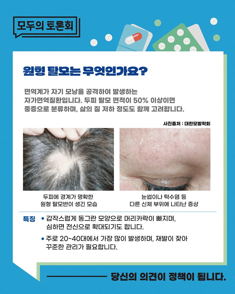 탈모치료제 건강보험 급여 적용, 확대해야 할까요?