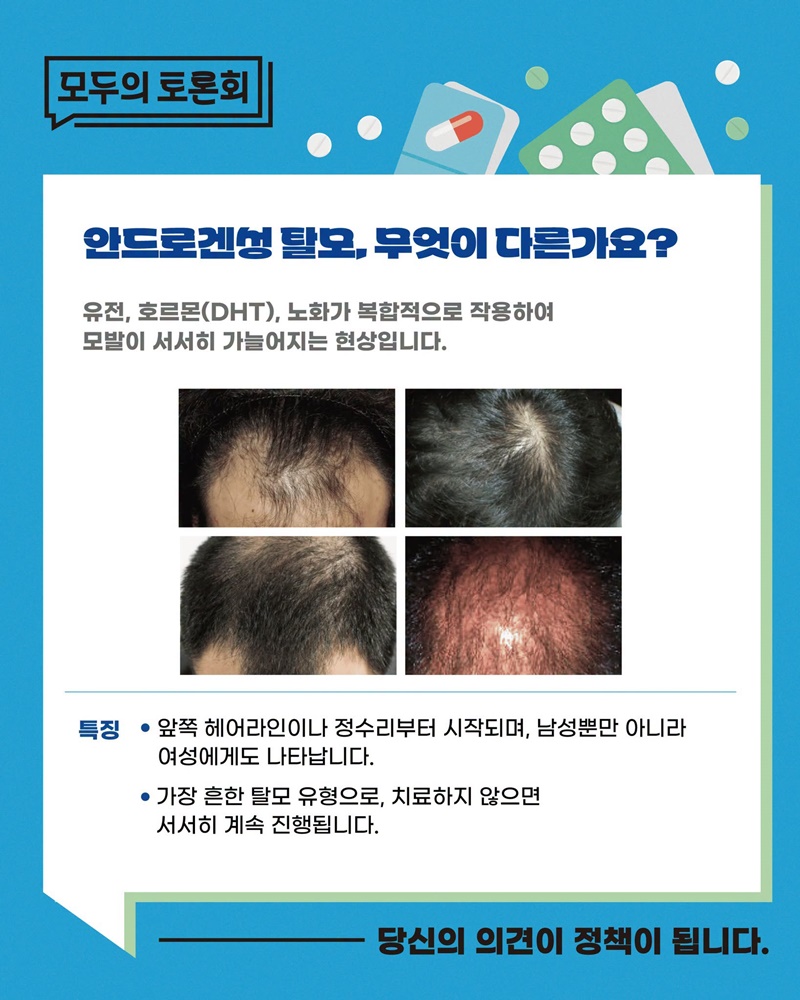 탈모치료제 건강보험 급여 적용, 확대해야 할까요?