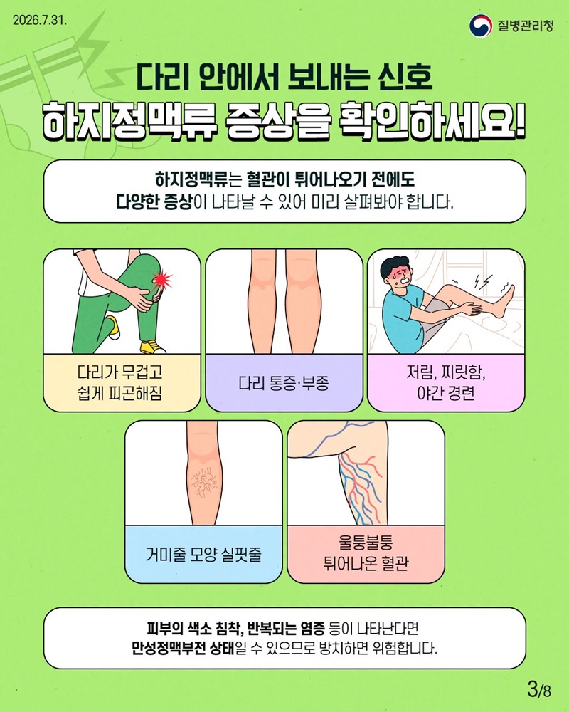 다리가 보내는 위험 신호, 하지정맥류 이렇게 관리해요