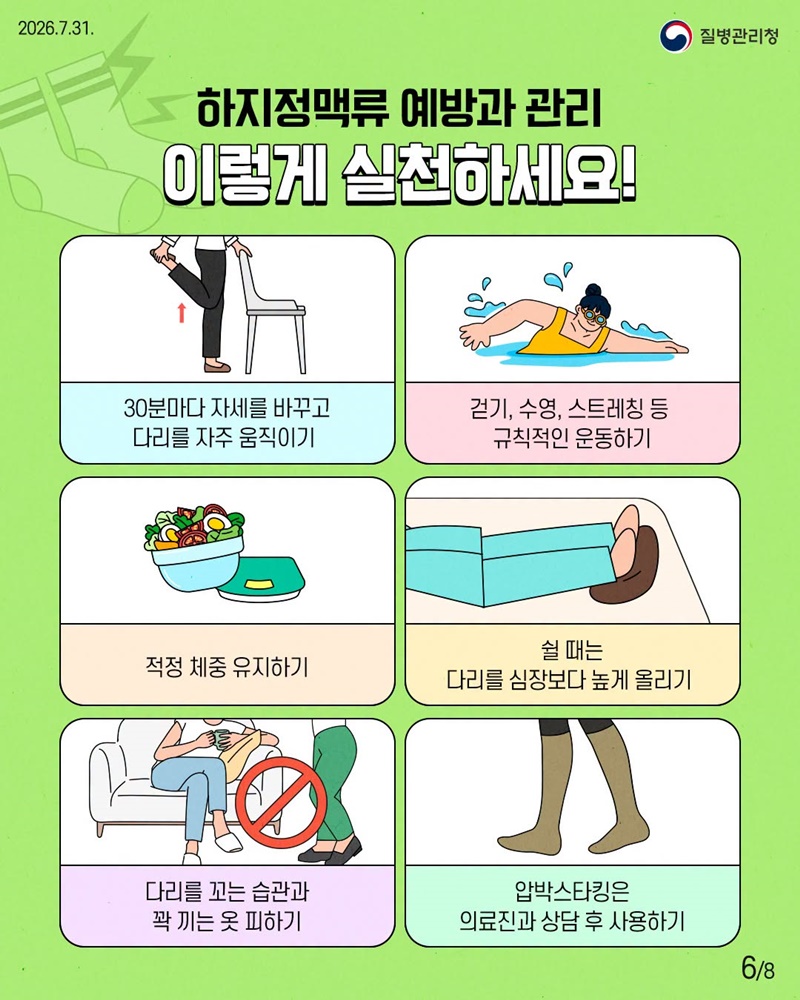 다리가 보내는 위험 신호, 하지정맥류 이렇게 관리해요