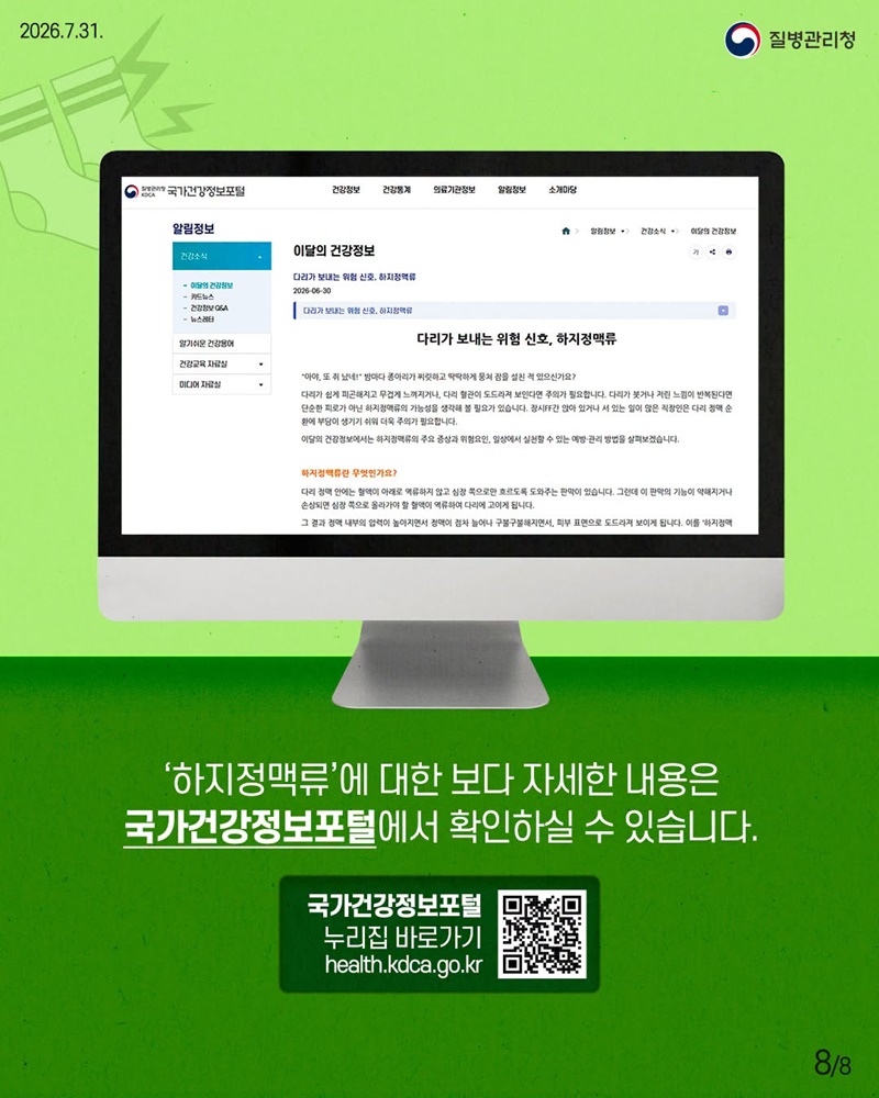 다리가 보내는 위험 신호, 하지정맥류 이렇게 관리해요