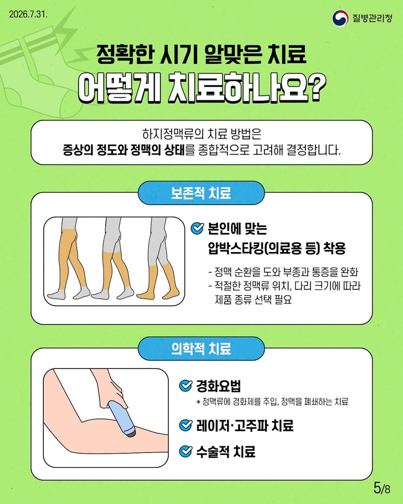 다리가 보내는 위험 신호, 하지정맥류 이렇게 관리해요
