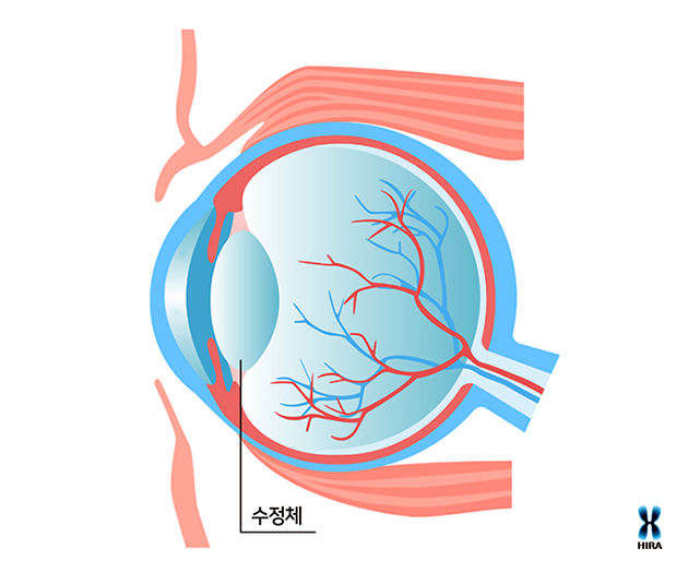 수정체.