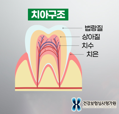 치아구조