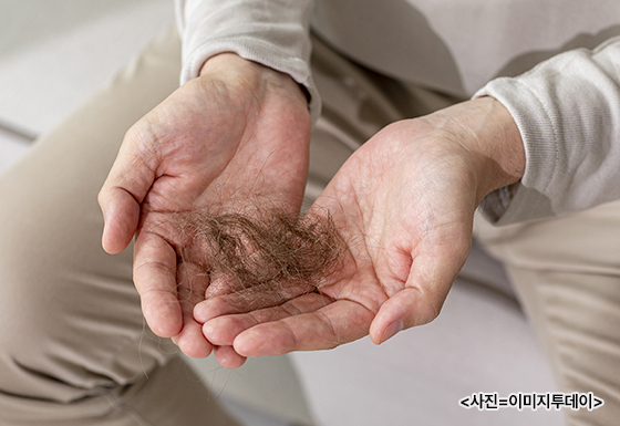 빠진 멈리카락을 손에 들고 있는 남자. 